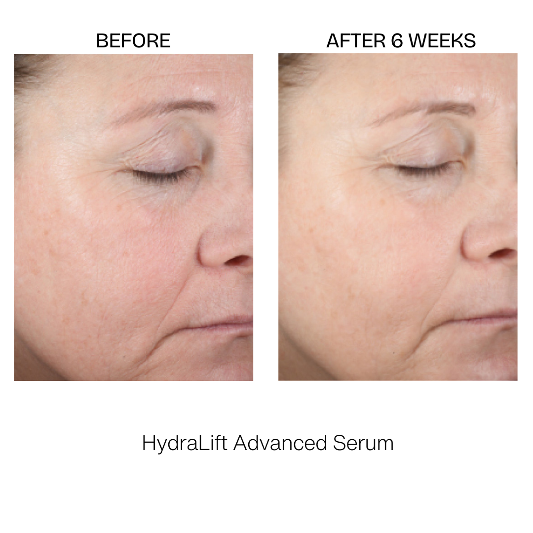 HydraLift Advanced Serum