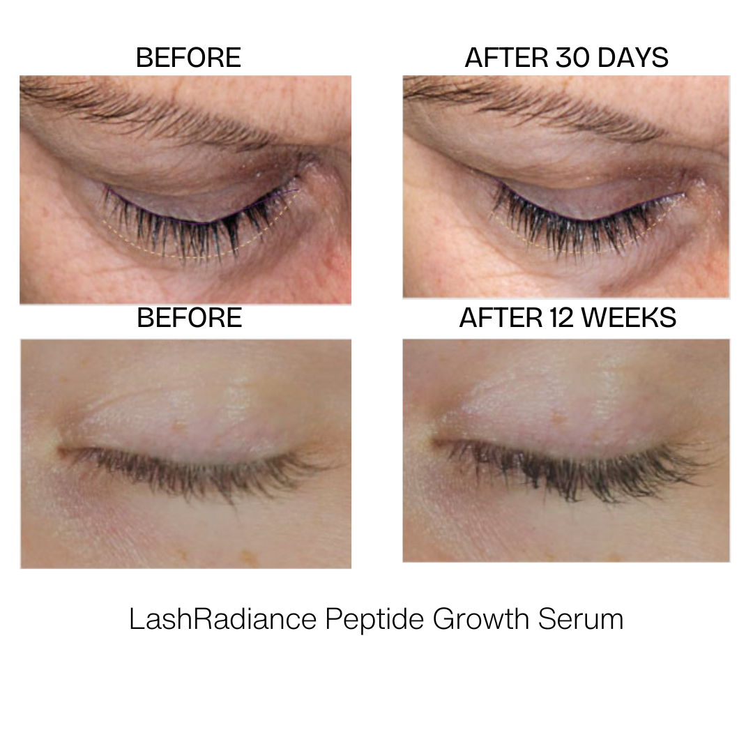LashRadiance Peptide Growth Serum