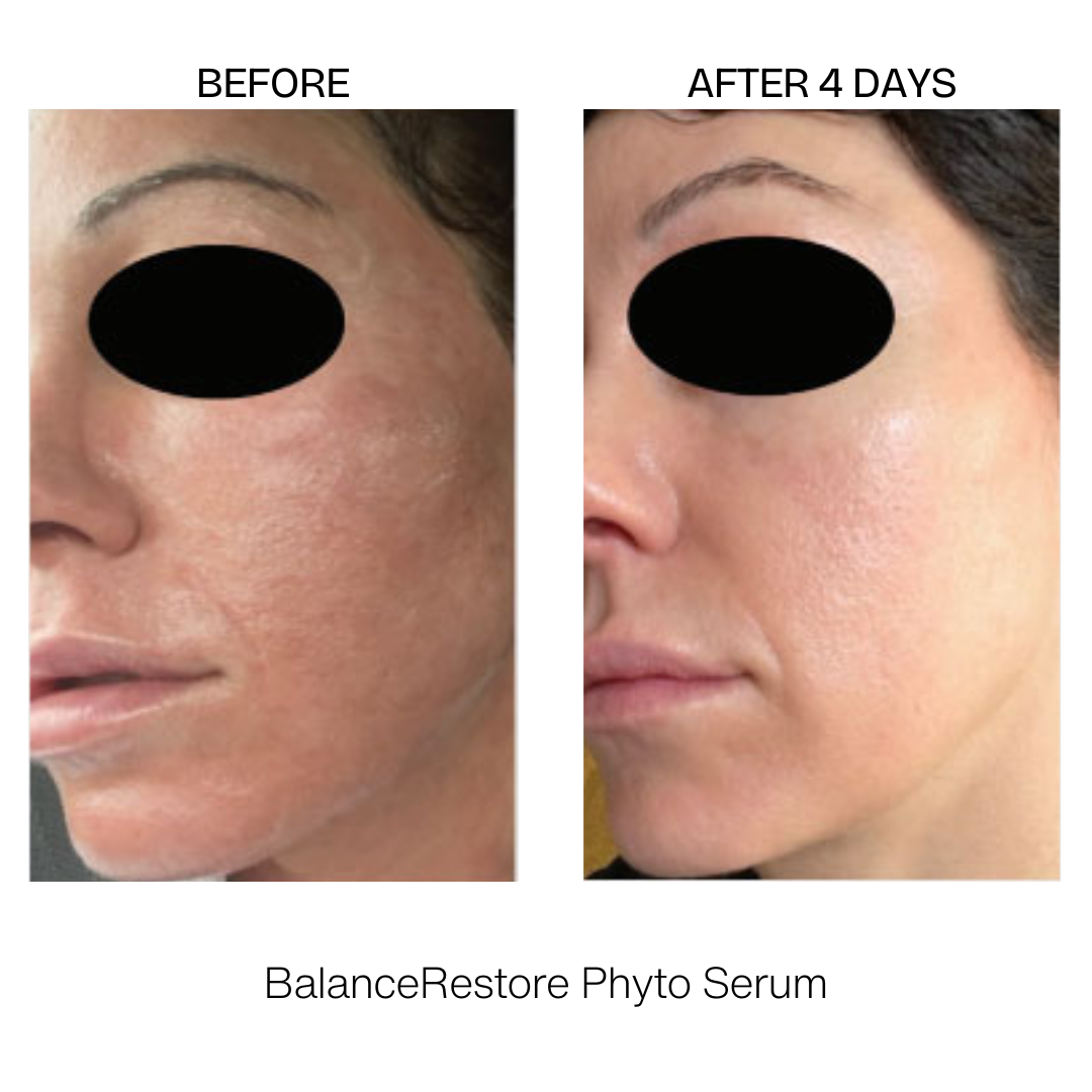 BalanceRestore Phyto Serum